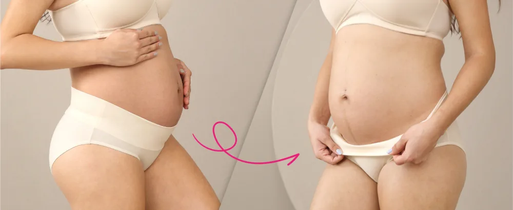 Intimate Portal Maternity Knickers | Pregnancy Postpartum Underwear | Foldable Under Bump Pants 16 6-pk Epitome - Foldable Maternity Underwear by Intimate Portal Pregnancy Must Have