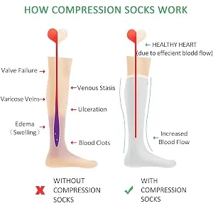 + MD Women's Tights Compression Stockings 15-20 mmHg Compression Stockings Winter Elastic Stockings Nude S-M - product information 5