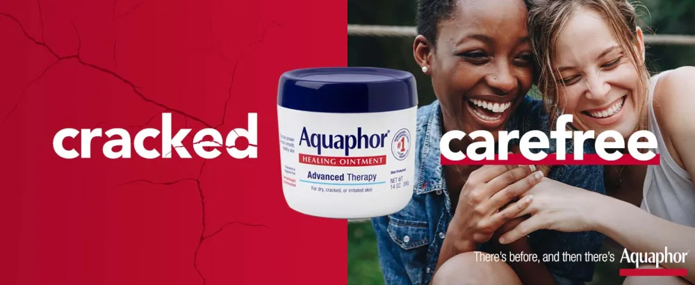 Aquaphor Healing ointment, skin protection, 14oz  - mens face moisturizer, face moisturizer for dry skin, moisturizer face, dry skin cream