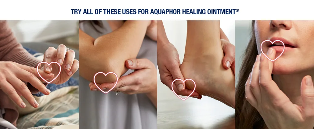 Aquaphor Healing Ointment Skin Protectant 3.5 oz (99 g) - aquaphor healing ointment, multipurpose solution, dry skin, cracked lips, chapped lips